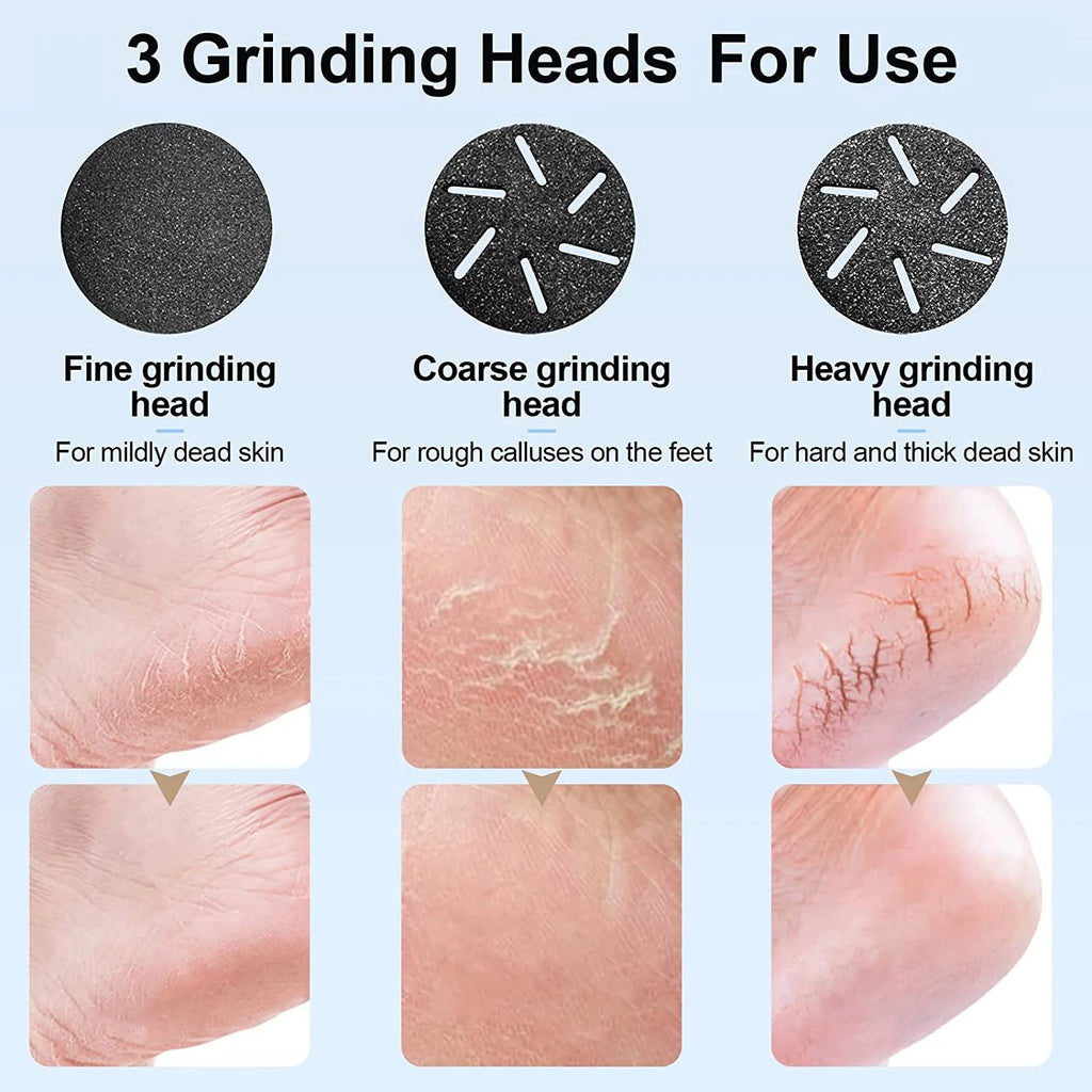 Prociv Electric Foot Callus Remover with Vacuum Cleaner, Rechargeable Foot File Dead Skin Remover with 2 Speed, 3 Grinding Head, LCD Display, Professional Kit for Foot Care Black